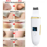 Ultrasonic Skin Scrubber: Facial Cleansing